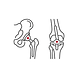 Protesis articulares.png