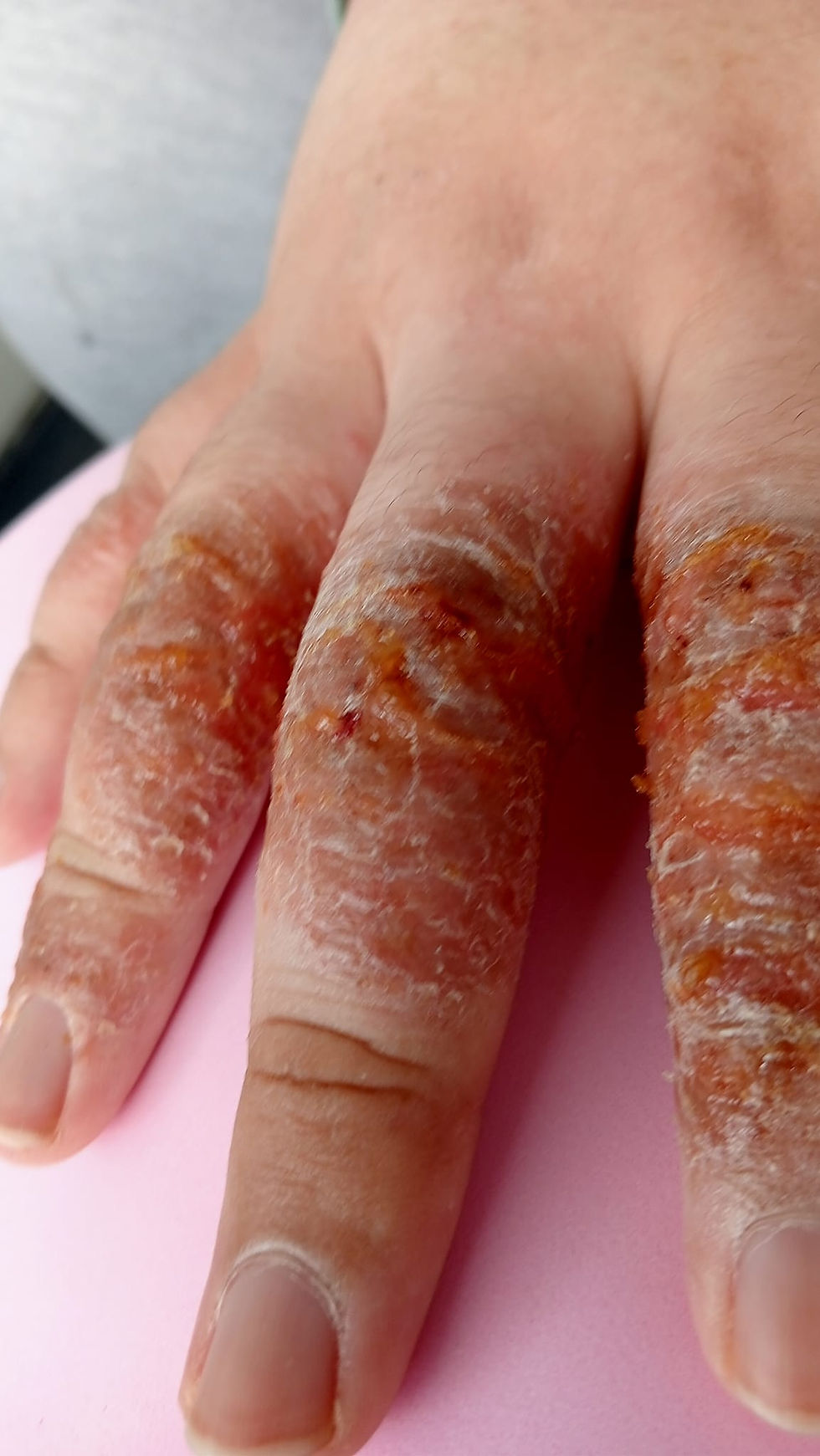 Thumbnail: All skin disease quantum cure