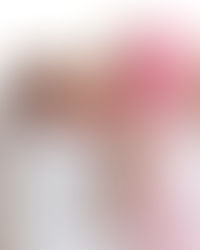 お肌の乾燥と疲労感