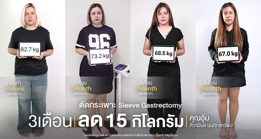 ตัดกระเพาะ(อุ้ม-ศิวามินต์-นนภัทรทรัพย์)web.jpg