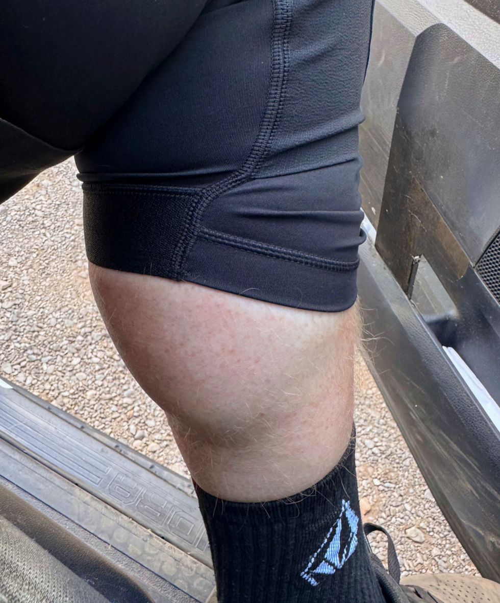 Close-up of a person's leg wearing black shorts and socks with a logo, seated in a vehicle with a gravel road visible outside.