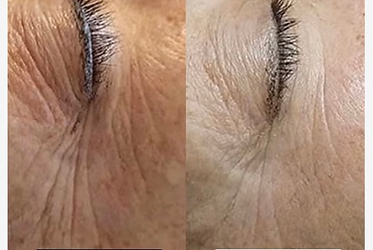 soin anti rides contour des yeux