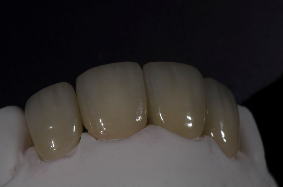 IPS e.max from Ivoclar