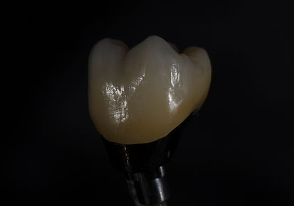 Cement Retained over Custom Abut 1.jpg