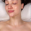 Thumbnail: the best chemical peel in Vaughan and Toronto. chemical peel near me.