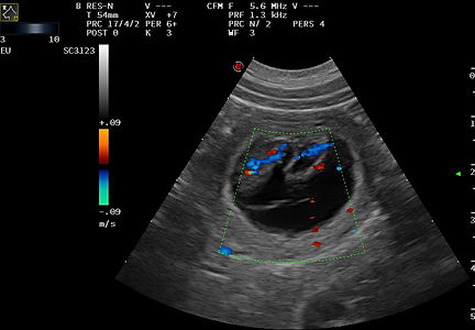 00040661_00083892_DICOM_US_2022_03_17_0000651582.jpg