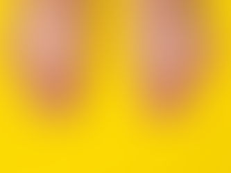 Chỉ số Acid Uric bao nhiêu là bình thường? Tìm hiểu nguyên nhân acid uric tăng cao, dấu hiệu bệnh gout và cách kiểm soát từ gốc theo Đông y tại Nhà thuốc Nam dược gia truyền Thuận Đức.