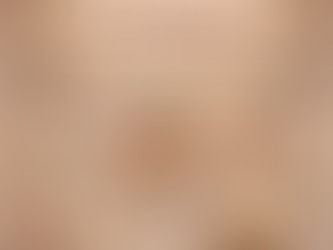 Thoát Vị Đĩa Đệm Cổ Gây Đau Đầu: 5 Nguyên Nhân Thường Gặp Và 4 Giải Pháp Cải Thiện Hiệu Quả