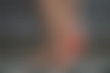 Gai gót chân có tự hết không? Tìm hiểu nguyên nhân khiến nhiều người đau gót chân kéo dài và cách chăm sóc, hỗ trợ theo Nam dược cổ truyền giúp gân cốt khỏe hơn.