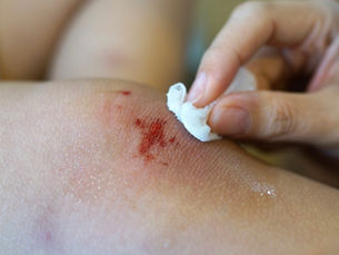 Public warned against use of contaminated non-sterile alcohol-free wipes