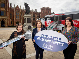 Action Cancer officially launches new skin cancer detection service across NI