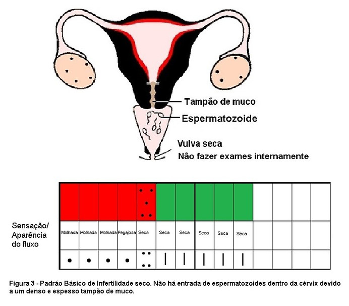Figura 3 - Padrão básico de infertilidade