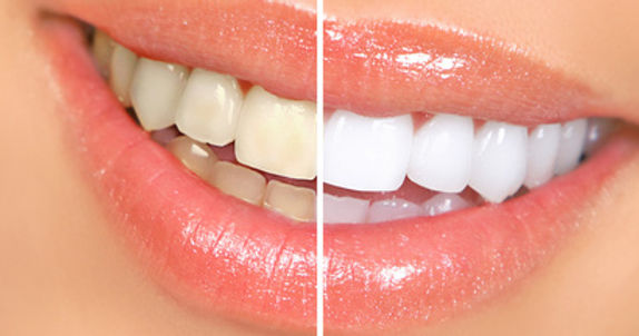 Estetica Dental Consultorio Julian Ramirez