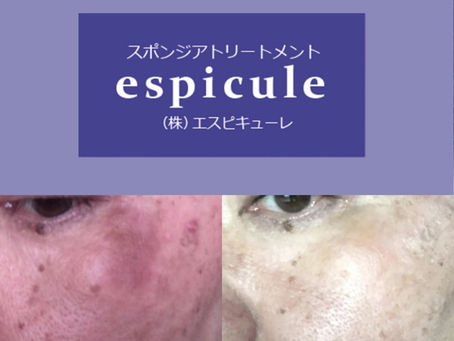 顔色が明るく。