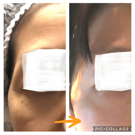 before-after