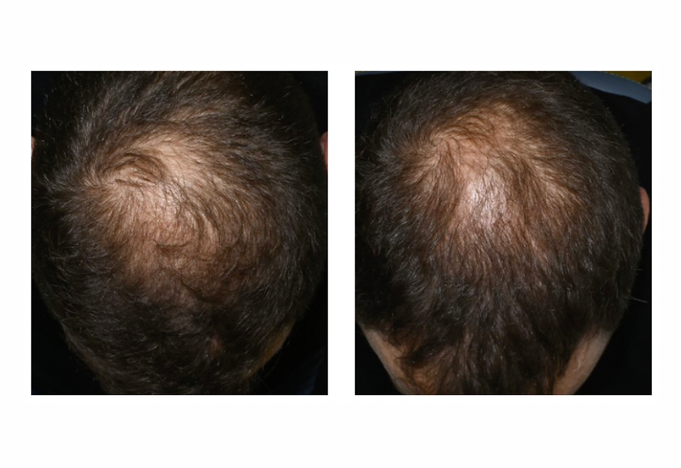 Before and After RedTouch Pro.png