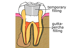 rct4.gif