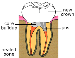 rct5.gif