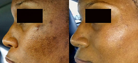 OIEMI Results Portfolio - Creole Cheek-1.jpg
