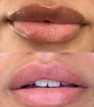 Lip blush aftercare healing stages, upper and lower lip closeup