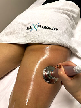 recell rf_edited.jpg