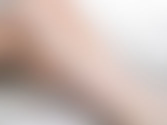 The Hidden Link Between Varicose Veins and Leg Cramps