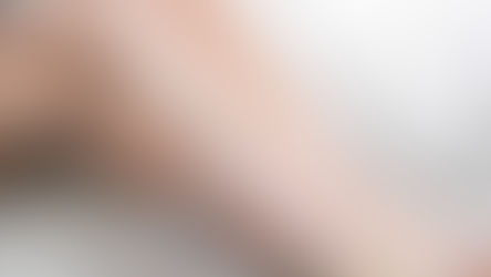 Varicose Veins Research Update 2026: What the Latest Evidence Means for Your Treatment