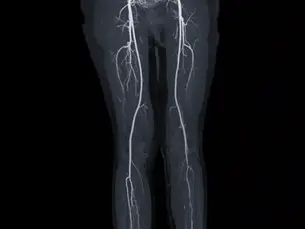 Expert Vascular Surgeon in Dubai: What You Need to Know Before Choosing a Specialist