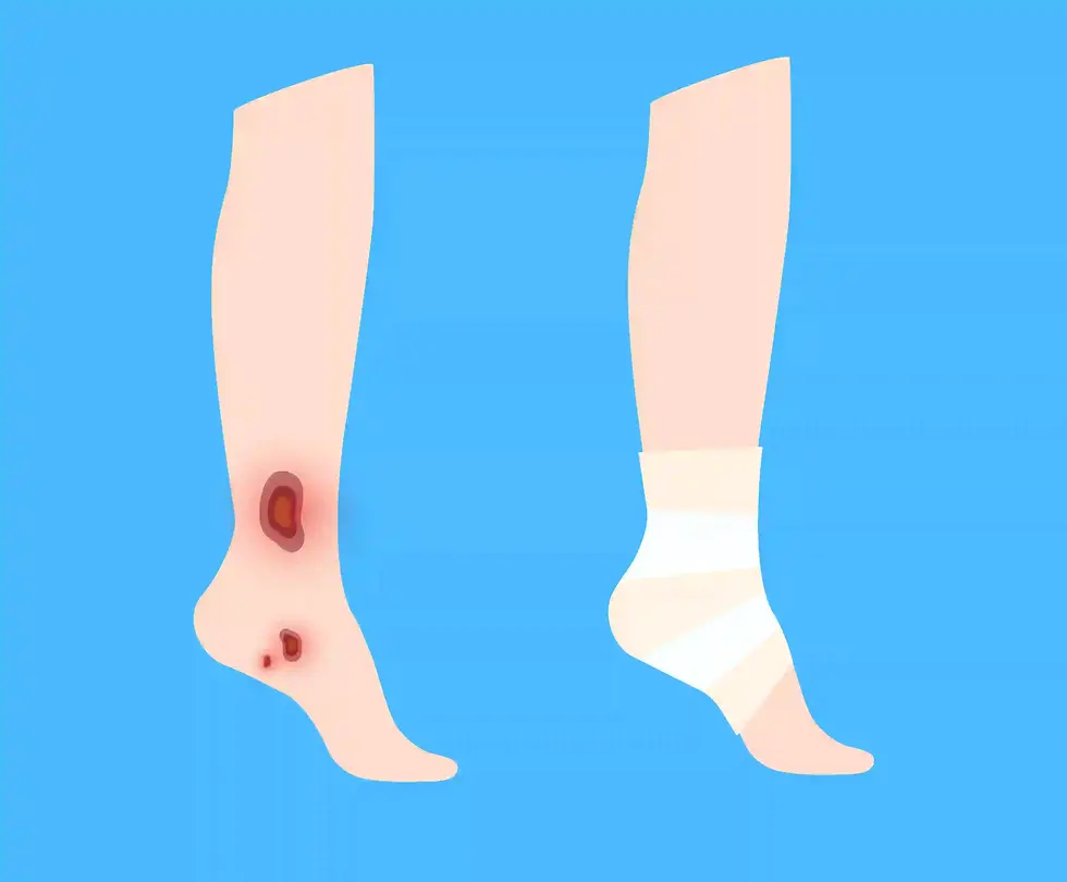 leg-ulcer-dubai (1).webp