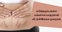 வரி தழும்புகள் மங்குவதற்கான 7 எளிமையான வீட்டுக் சிகிச்சை முறைகள்