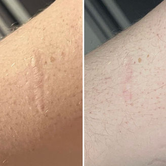scar camouflage.jpg