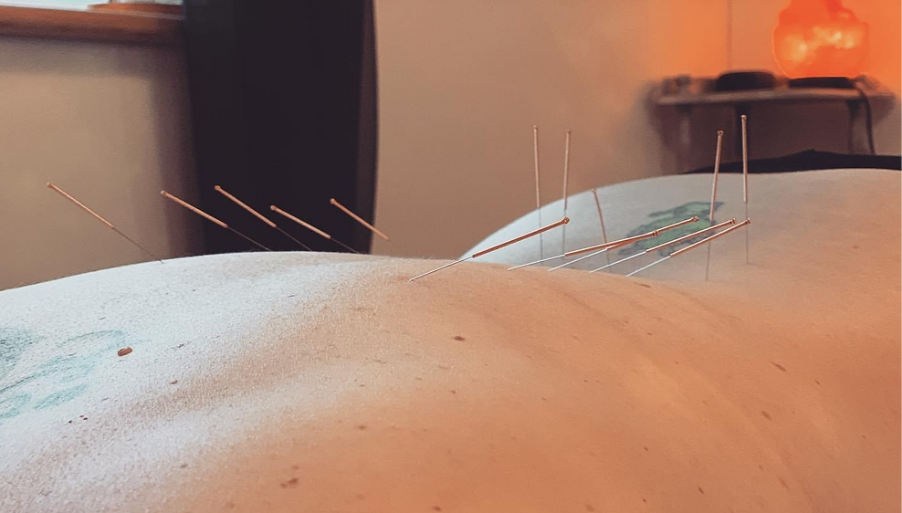 Acupunture_edited.png