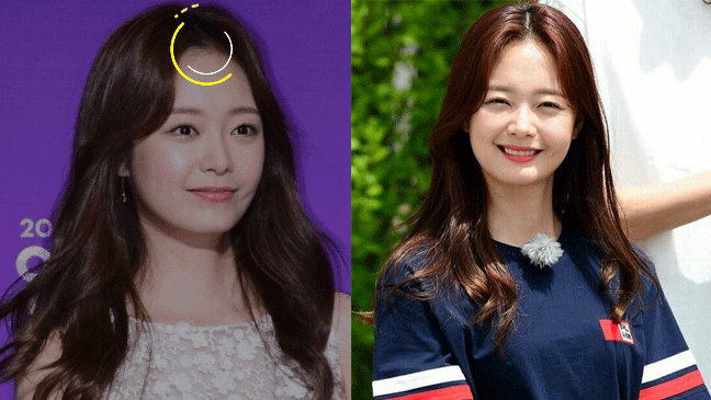 Thành viên bị ghét nhất Running Man Hàn: Mặt to, trán rộng và chuyên phải &quot;lợi dụng&quot; 3 kiểu tóc để che nhược điểm - Ảnh 7.