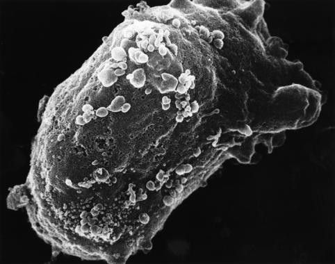 Vista al microscopio electrónico de un linfocito con VIH. (Foto: National Cancer Institute)