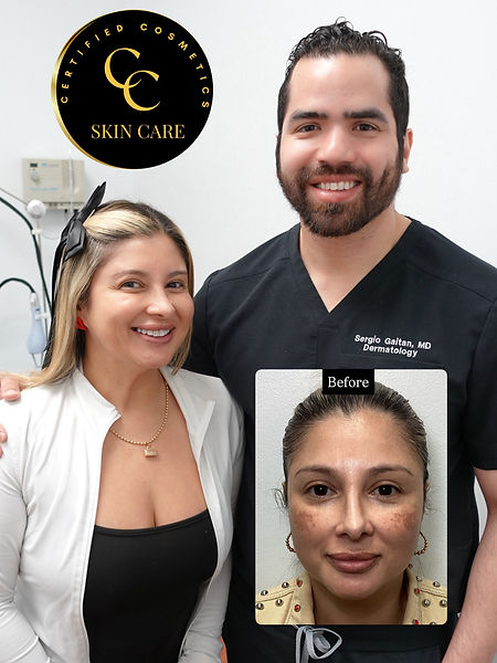 Melasma Patient Testimonial