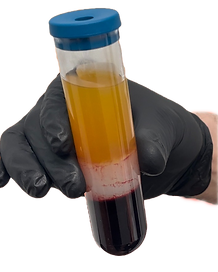 PRP that can be used for Skin Tightening Miami