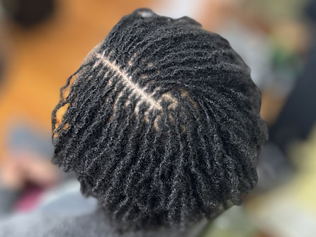 9 Week Microloc Retightening 