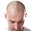 Miniature : Micropigmentation Capillaire Homme