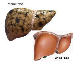 כורכום ומחלת הכבד השומני הלא אלכוהולית NAFLD