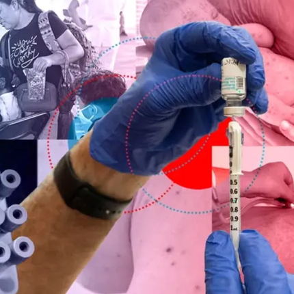 Alerta para pacientes con diabetes, Casos de sarampión en México superan los 15 mil  