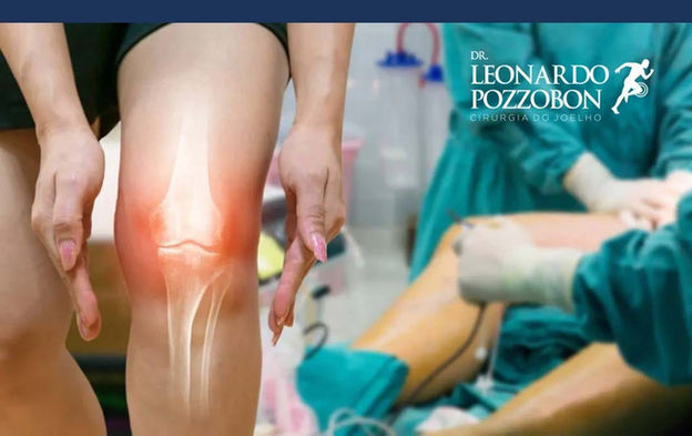 O que você precisa saber sobre o pré e pós-operatório de uma cirurgia no joelho.