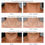 Thumbnail: iS CLINICAL NeckPerfect Complex, 1.7 oz