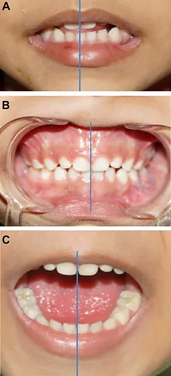 gr4.jpg.webp