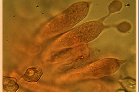 Entoloma_cetratum_baside.jpg