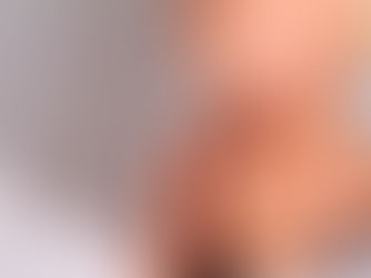 ¿Tiene hipotiroidismo? Experto explica el diagnóstico y lo qué significa