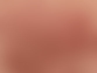 Nueva infección fúngica de transmisión sexual afectaría principalmente a hombres