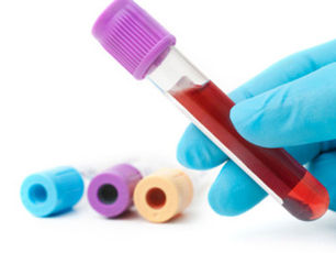 Usos de la Procalcitonina.