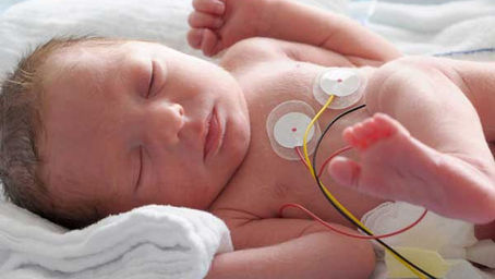 un bebe recien nacido delicado de salud