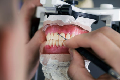 Premium Denture Setup