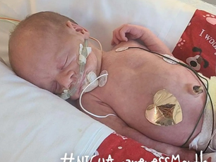 A #NICUAwareness Month Story: Liam Campbell